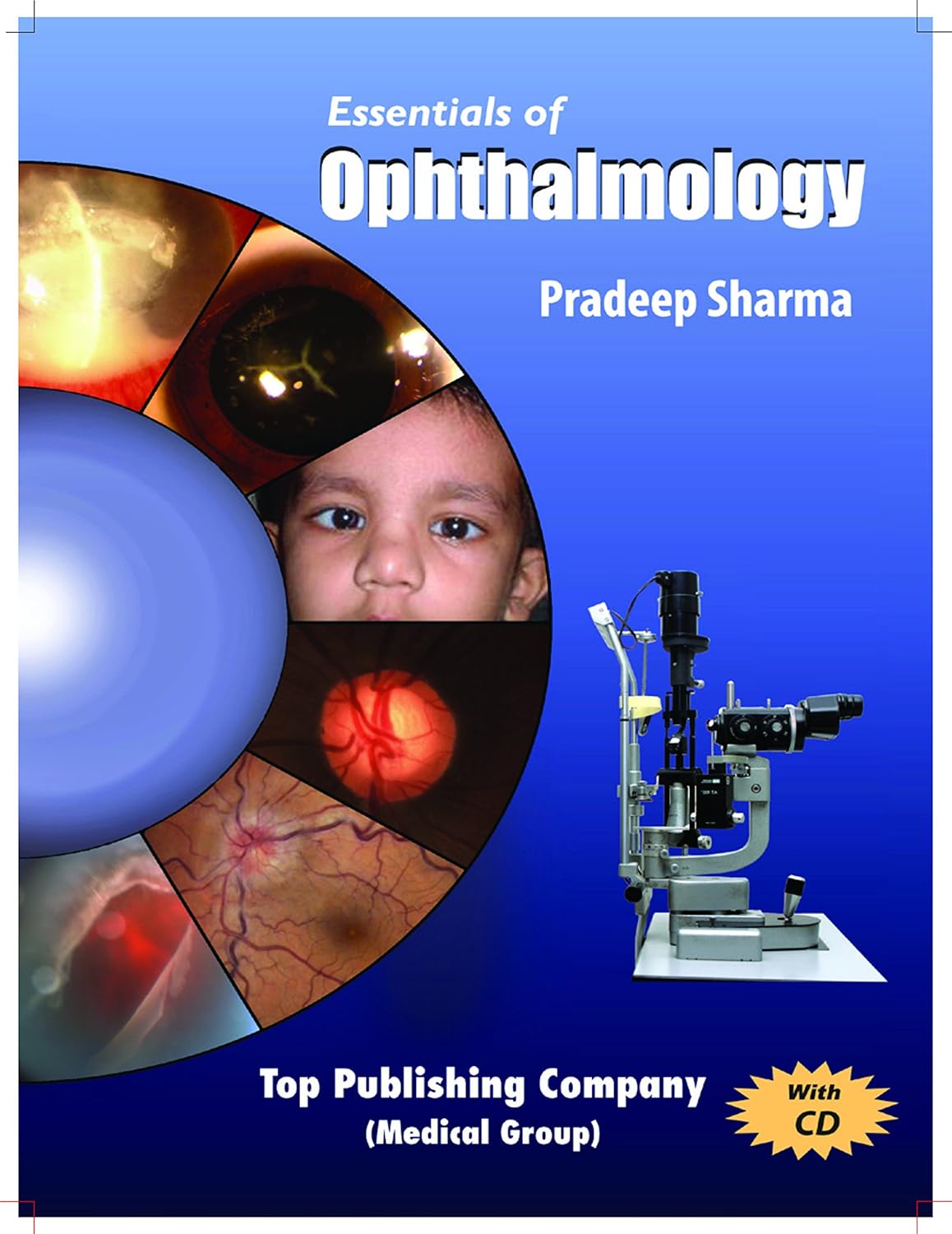 ESSENTIALS OF OPHTHALMOLOGY 2ND/2011-PRADEEP SHARMA