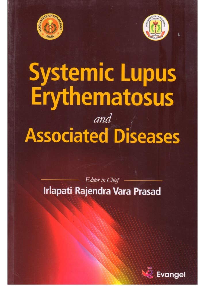 SYSTEMIC LUPUS ERYTHEMATOSUS AND ASSOCIATED DISEASE 1ST/2019-IRLAPATI RVP