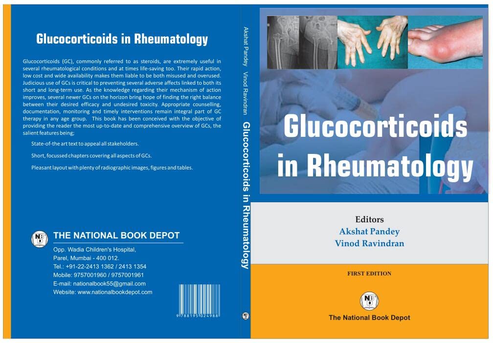GLUCOCORTICOIDS IN RHEUMATOLOGY 1ST/2022 - AKSHAT PANDEY
