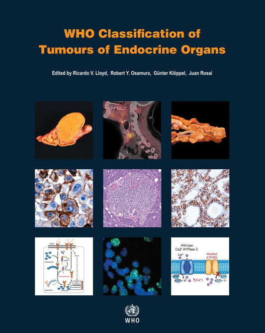 WHO CLASSIFICATION OF TUMOURS OF ENDOCRINE ORGANS 4TH/2017 - R V LYOD