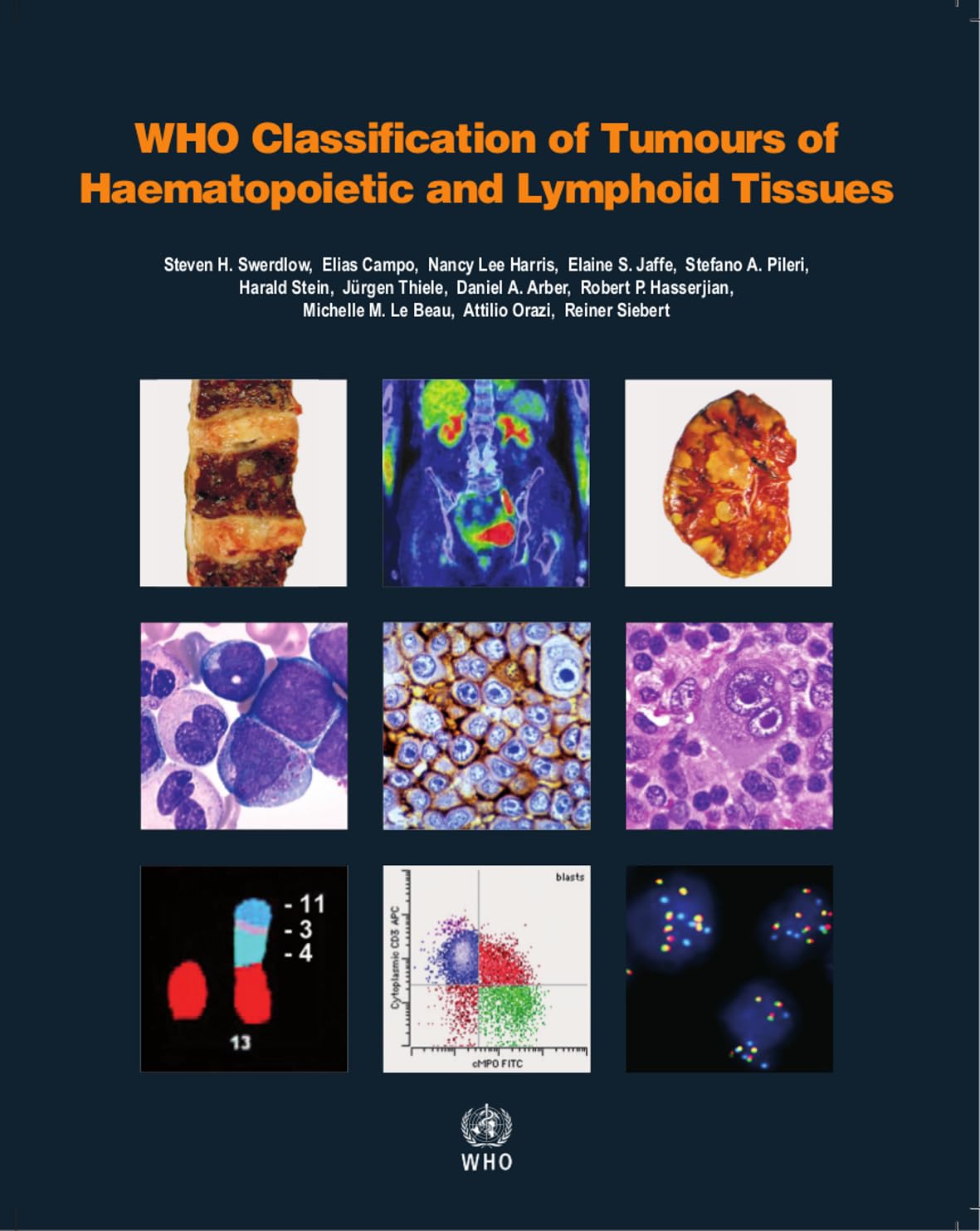 WHO CLASSIFICATION OF TUMOURS OF HAEMATOPOIETIC AND LYMPHOID TISSUES: VOL. 2 4TH/2017 - SWERDLOW
