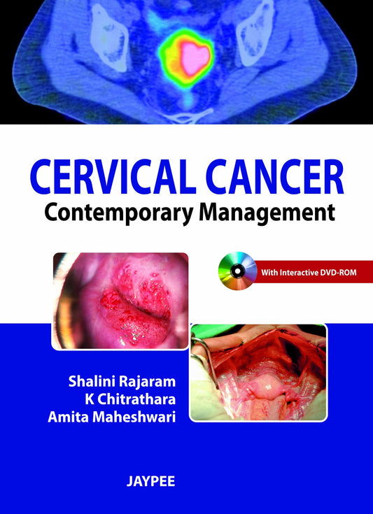 CERVICAL CANCER CONTEMPORARY MANAGEMENT 1ST/2012 - SHALINI RAJARAM