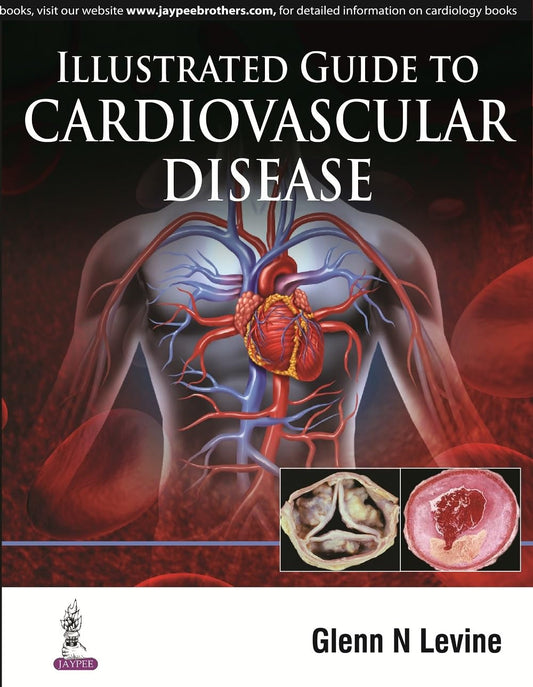 ILLUSTRATED GUDIE TO CARDIOVASCULAR DISEASE 1ST/2016 - GLENN LEVINE