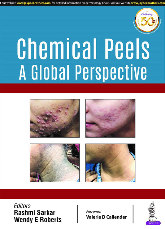 CHEMICAL PEELS A GLOBAL PERSPECTIVE 1ST/2019 RASHMI SARKAR