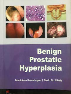 BENIGN PROSTATIC HYPERPLASIA 1ST/2014 - MANICKAM RAMALINGAM
