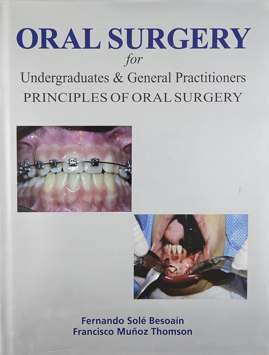 ORAL SURGERY FOR UNDERGRADUATES & GENERAL PRACTITIONERS : PRINCIPLES OF ORAL SURGERY 1ST/2013 - FERNANDO SOLE BESOAIN