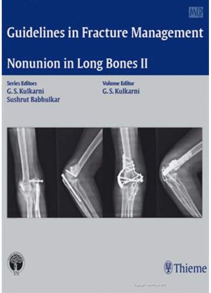 GUIDELINES IN FRACTURE MANAGEMENT-NONUNION IN LONG BONES II 1ST/2016-SUSHRAT BABHULKAR