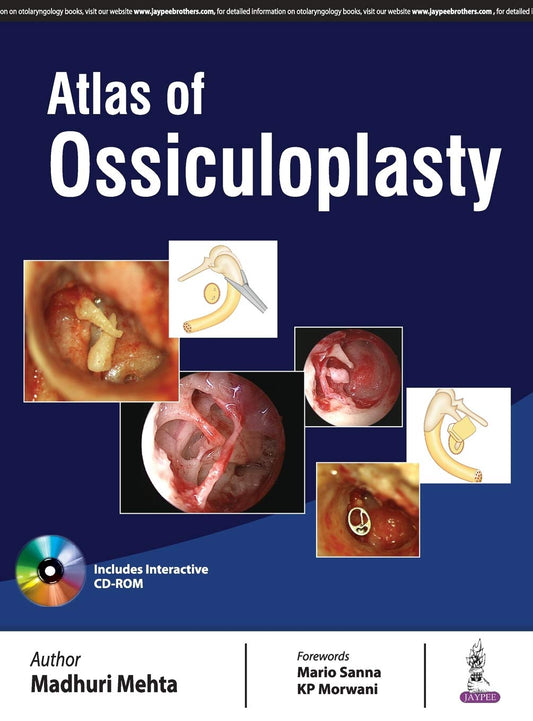 ATLAS OF OSSICULOPLASTY 1ST/2017-MADHURI MEHTA