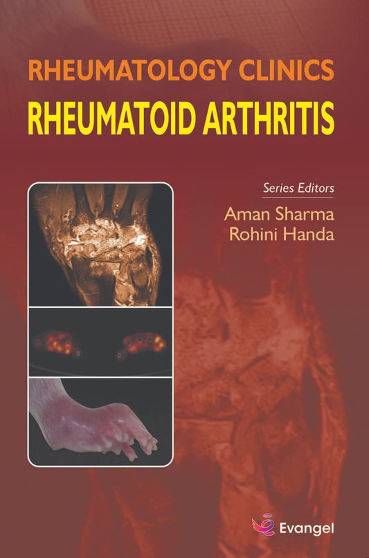 RHEUMATOLOGY CLINICS RHEUMATOID ARTHRITIS 1ST/2022 - AMAN SHARMA