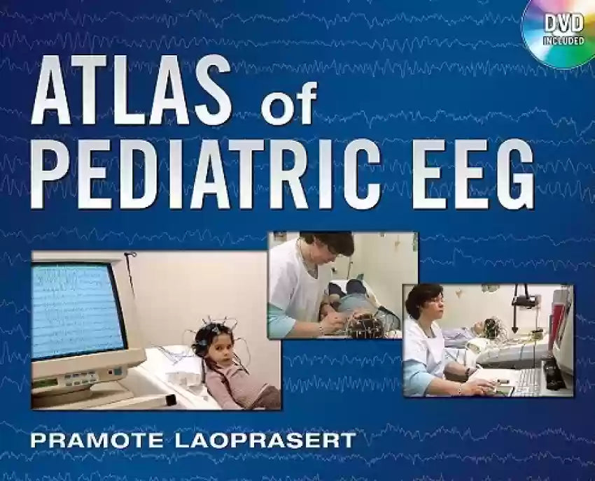 ATLAS OF PEDIATRIC EEG 1E/2011(WITHOUT DVD)