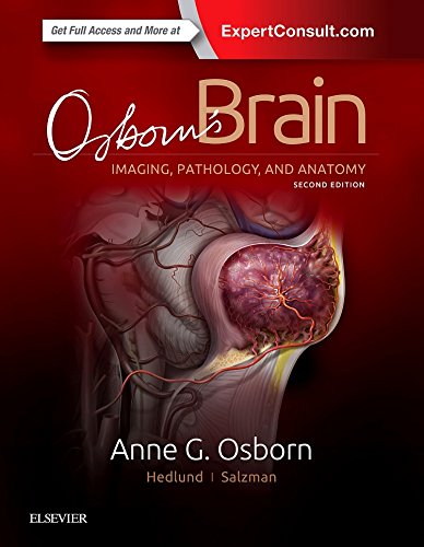 OSBORN'S BRAIN, 2ND/2017 - ANNE OSBORN