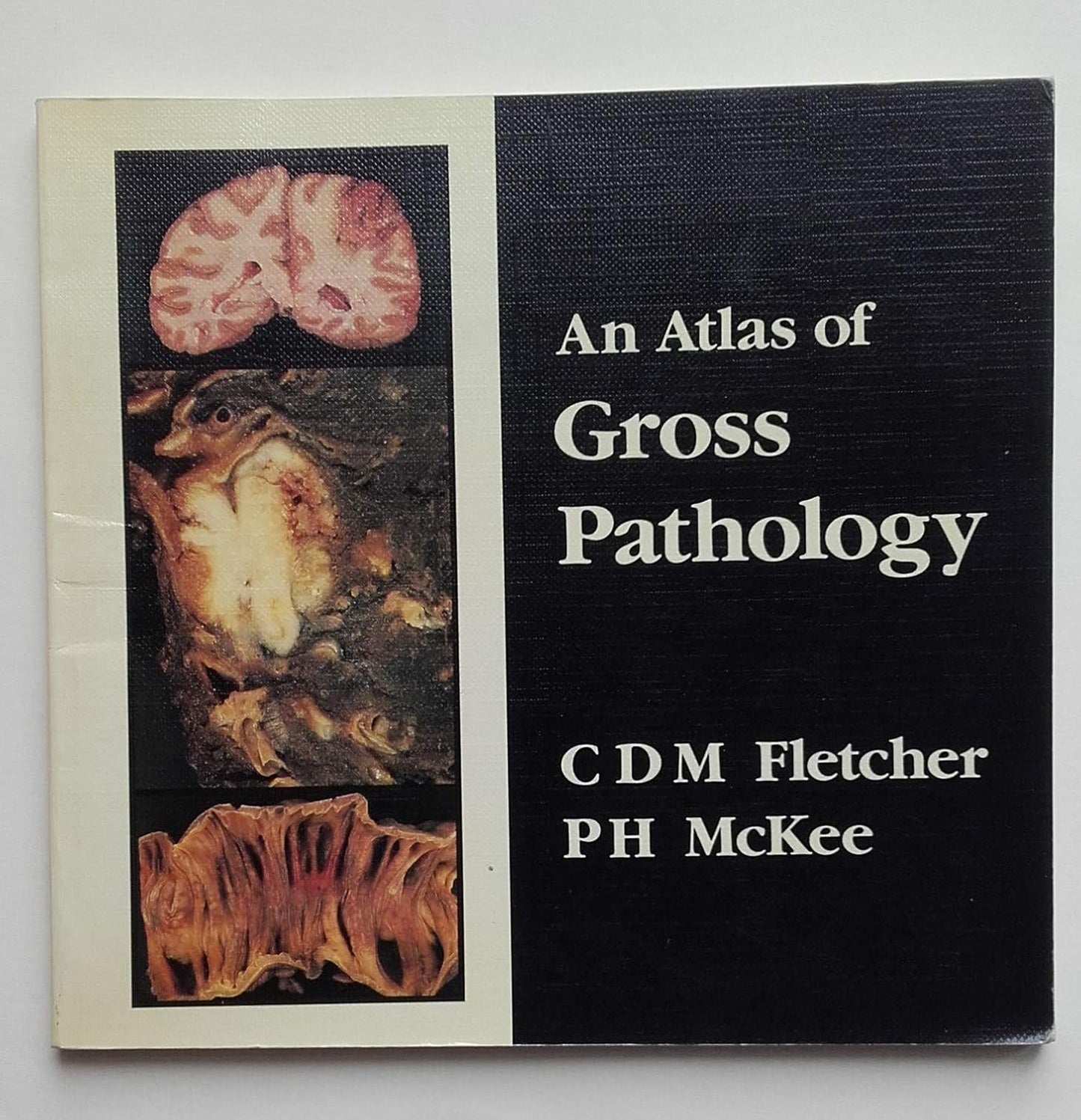 AN ATLAS OF GROSS PATHOLOGY 1ST/1987 - FLETCHER