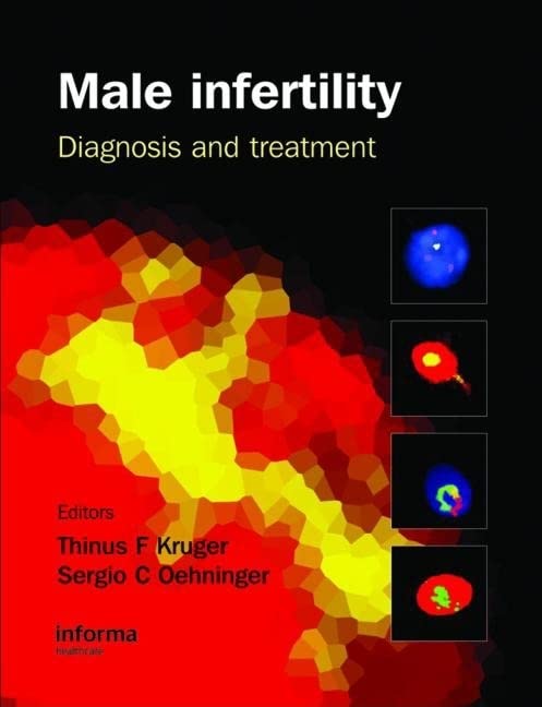 MALE INFERTILITY DIAGNOSIS AND TREATMENT 1ST/2007 - SERGIO OEHNINGER