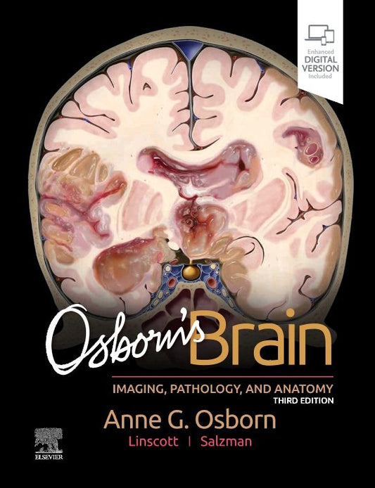 Osborns Brain: Imaging, Pathology and Anatomy 3rd/2024