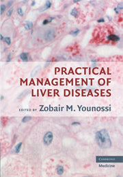 PRACTICAL MANAGEMENT OF LIVER DISEASES 1E/2008