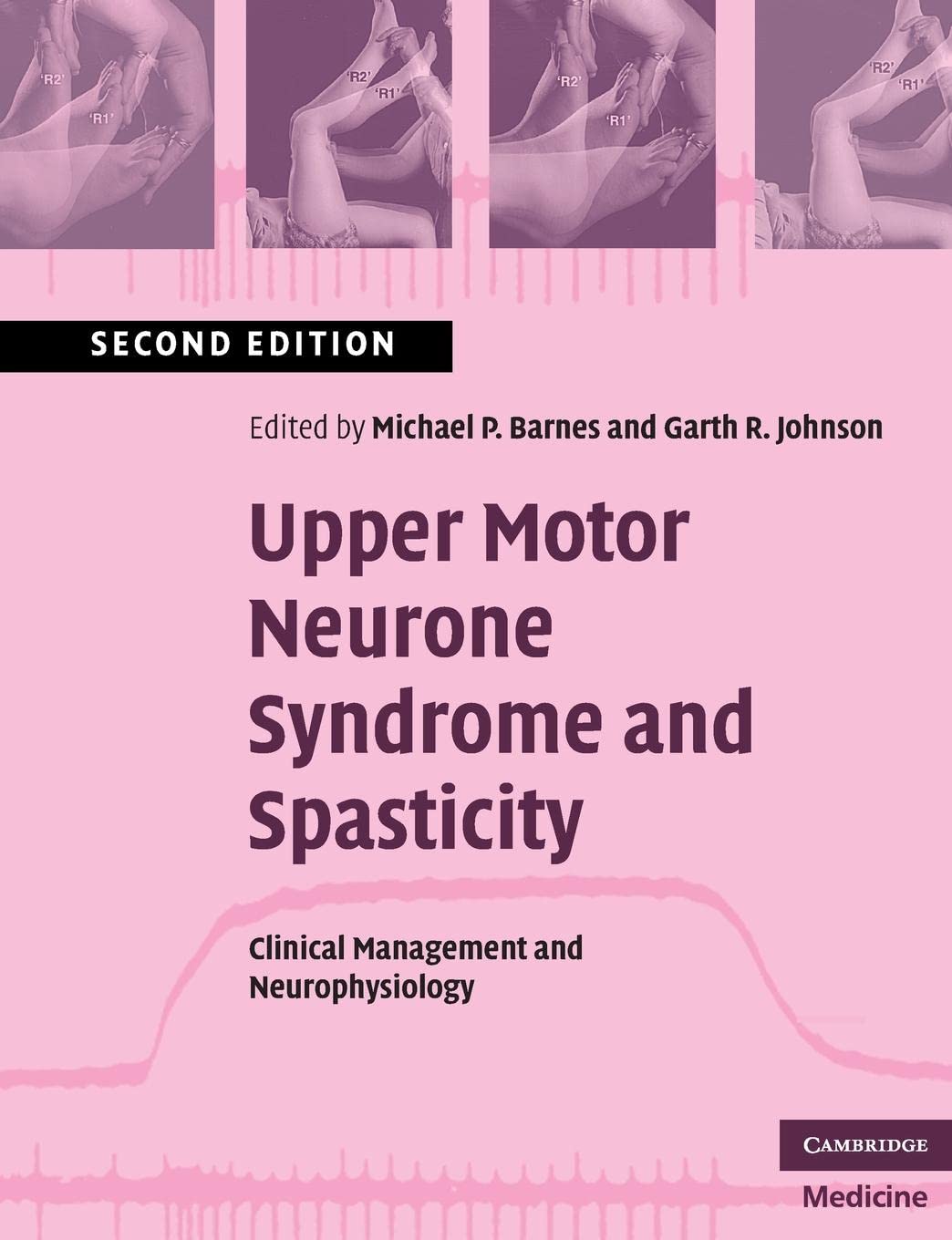 UPPER MOTOR NEURONE SYNDROME AND SPASTICITY 2E/2008