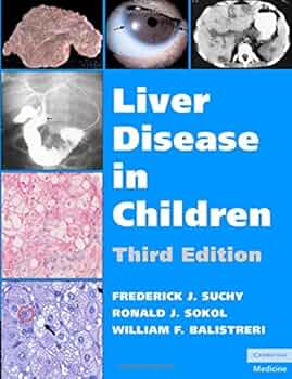 LIVER DISEASE IN CHILDREN 3E/2007