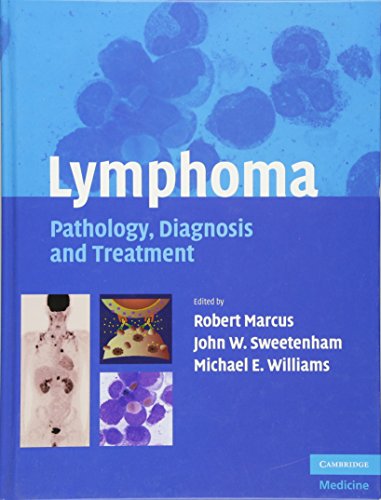 LYMPHOMA PATHOLOGTY DIAGNOSIS AND TREATMENT 1E/2007