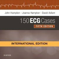 150 ECG Cases 5th/2019