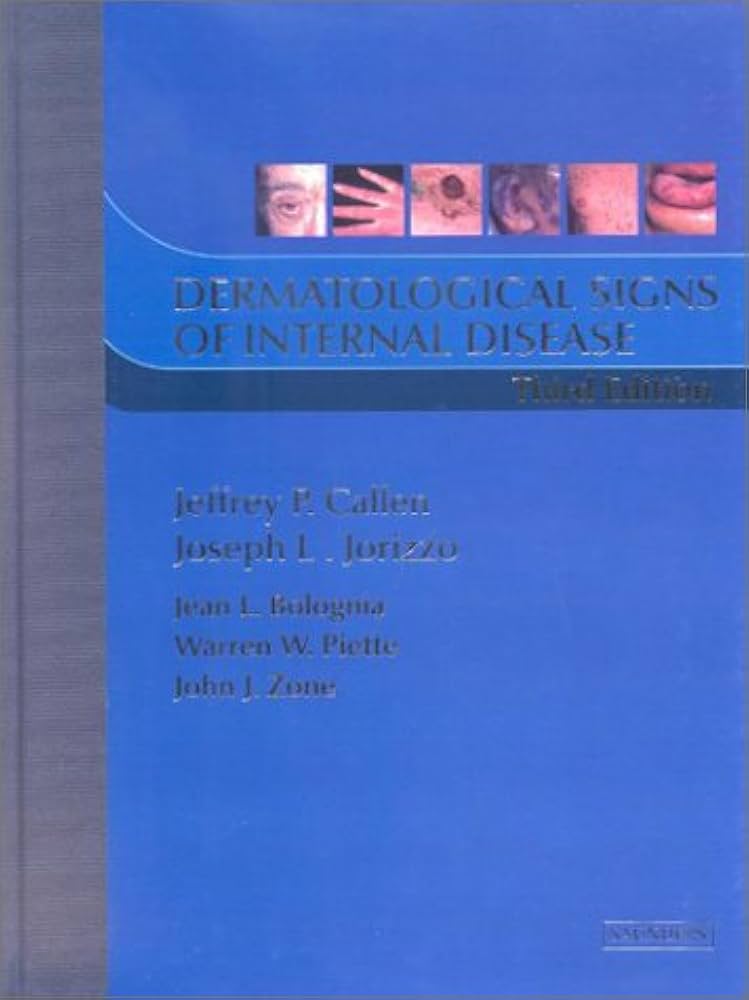 DERMATOLOGICAL SIGNS OF INTERNAL DISEASE 3RD/2003-JEFFREY P CALLEN