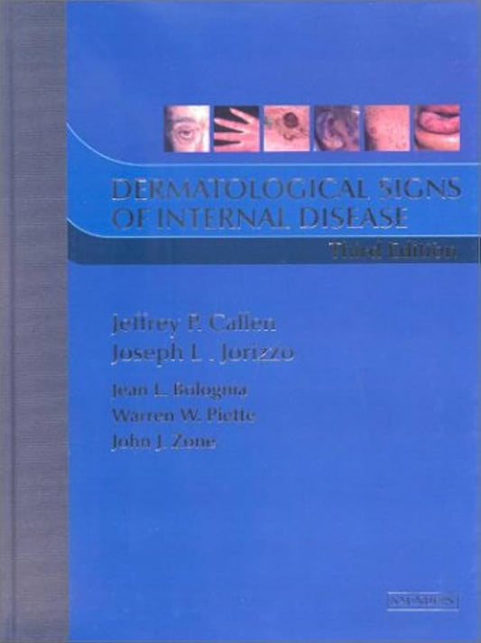DERMATOLOGICAL SIGNS OF INTERNAL DISEASE 3RD/2003-JEFFREY P CALLEN