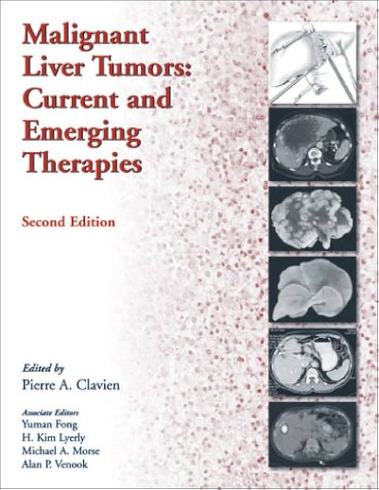 MALIGNANAT LIVER TUMORS CURRENT AND EMERGING THERAPIES 2E/2003