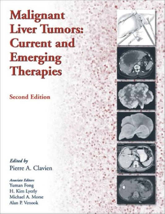 MALIGNANAT LIVER TUMORS CURRENT AND EMERGING THERAPIES 2E/2003