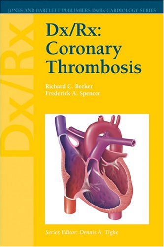 DX/RX CORONARY THROMBOSIS 1ST/2004 - RICHARD BECKER