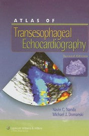 ATLAS OF TRANSESOPHAGEAL ECHOCARDIOGRAPHY 1E/2007