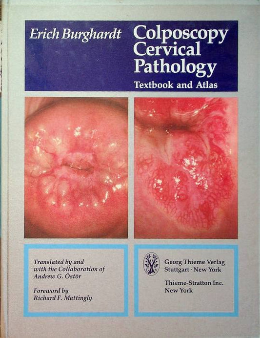 COLPOSCOPY CERVICAL PATHOLOGY TEXTBOOK AND ATLAS 1ST/1984 - ERICH BURGHARDT