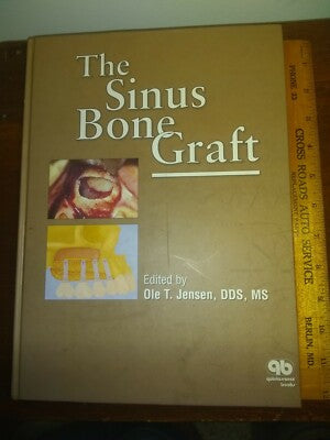 THE SINUS BONE GRAFT 1ST/1999 - OLE T JENSEN