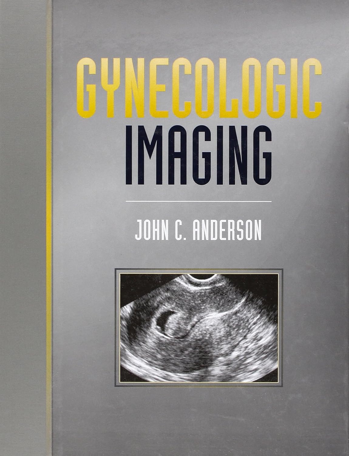 GYNECOLOGIC IMAGING 1ST/1998 - JOHN ANDERSON