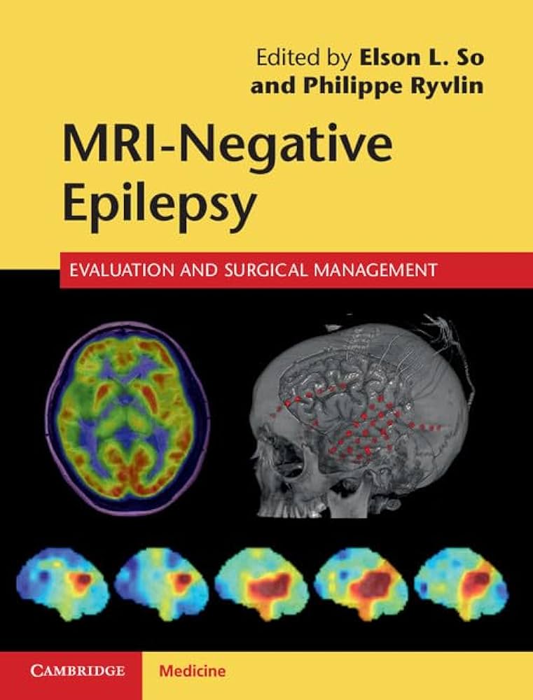 MRI NEGATIVE EPILEPSY EVALUATION AND SURGICAL MANAGEMENT 1E/2015