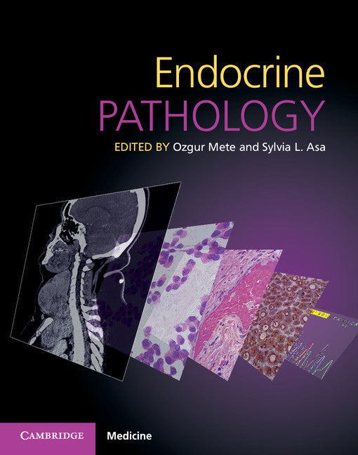 ENDOCRINE PATHOLOGY 1ST/2017 - OZGUR METE
