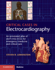 CRITICAL CASES IN ELECTROCARDIOGRAPHY 1E/2018