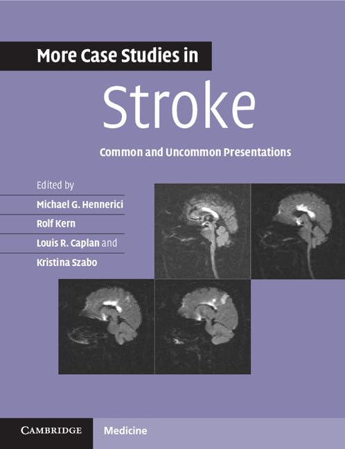 MORE CASE STUDIES IN STROKE COMMON AND UNCOMMON PRESENTATIONS 1E/2014