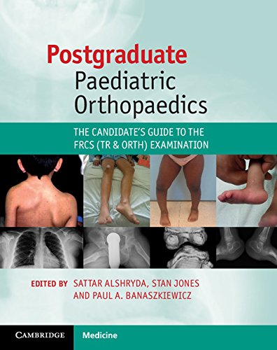 POSTGRADUATE PAEDIATRIC ORTHOPAEDICS: THE CANDIDATE'S GUIDE TO THE FRCS (TR AND ORTH) EXAMINATION 1ST/2014 - SATTAR ALSHRYDA