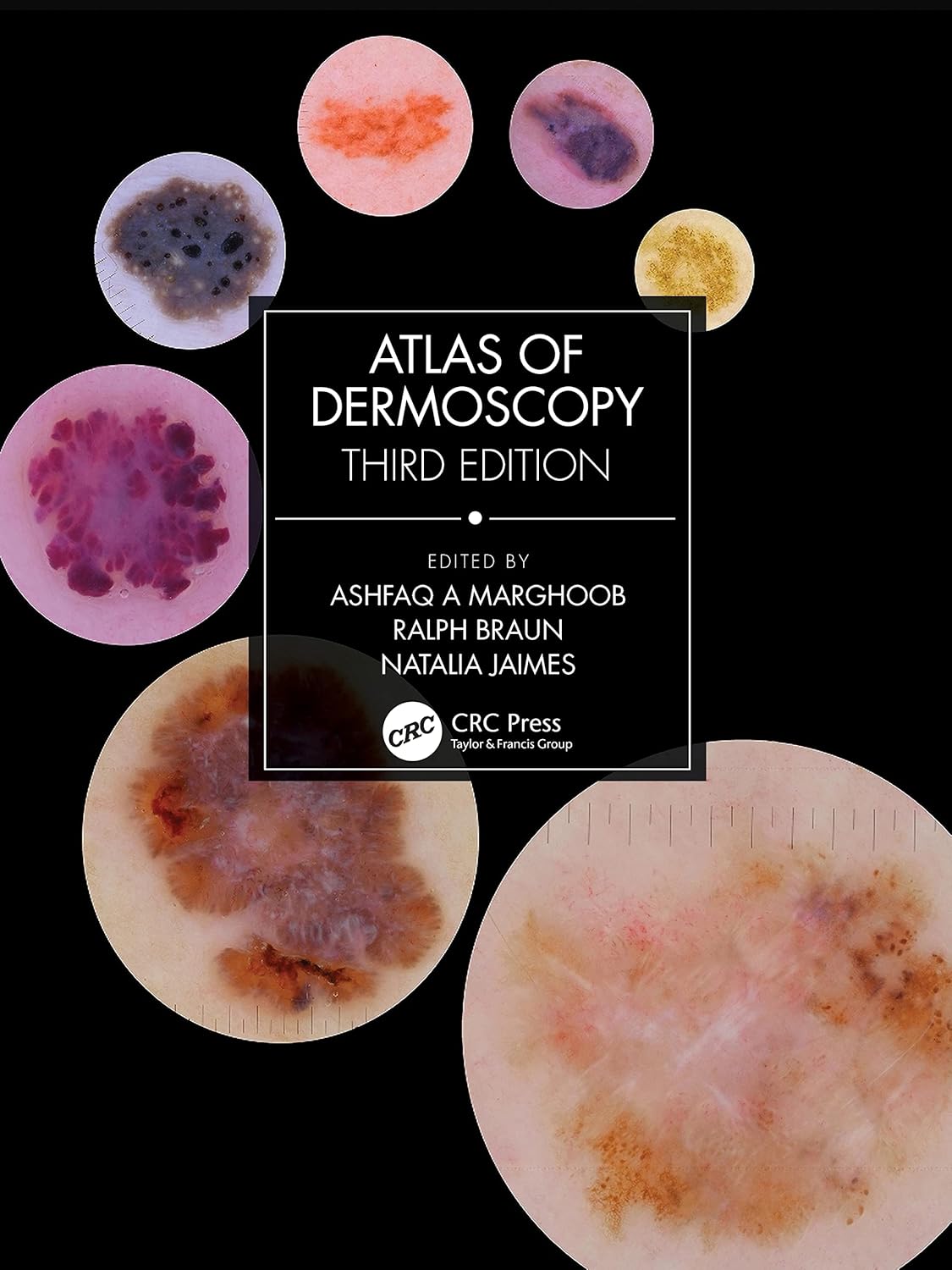 ATLAS OF DERMOSCOPY 3RD/2023 - ASHFAQ A MARGHOOB
