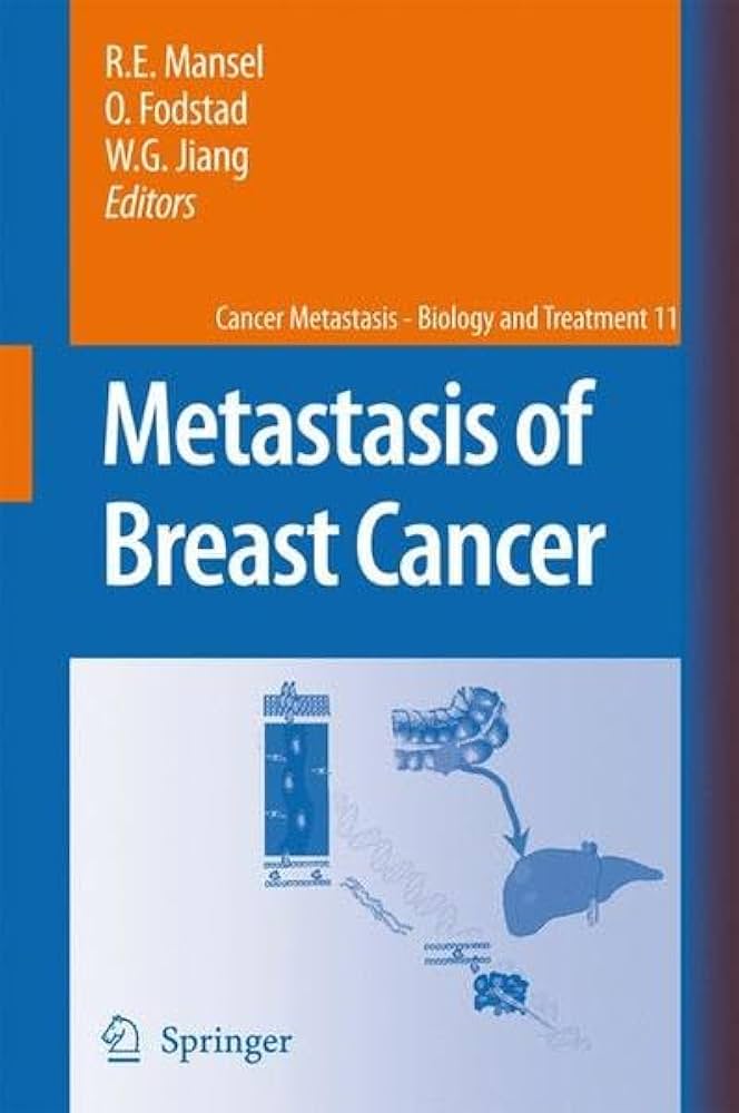 METASTASIS OF BREAST CANCER 1E/2008