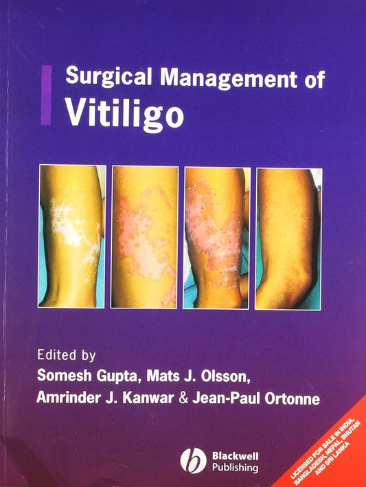 SURGICAL MANAGEMENT OF VITILIGO 1ST/2007-SOMESH GUPTA