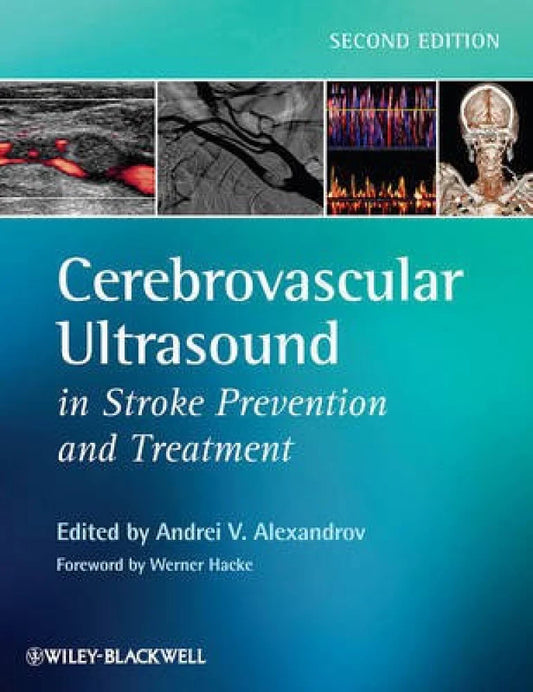 CEREBROVASCULAR ULTRASOUND IN STROKE PREVENTION AND TREATMENT 2E/2011