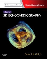 ATLAS OF 3D ECHOCARDIOGRAPHY 1E/2012