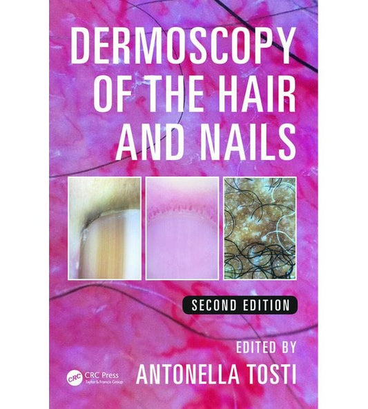 DERMOSCOPY OF THE HAIR AND NAILS