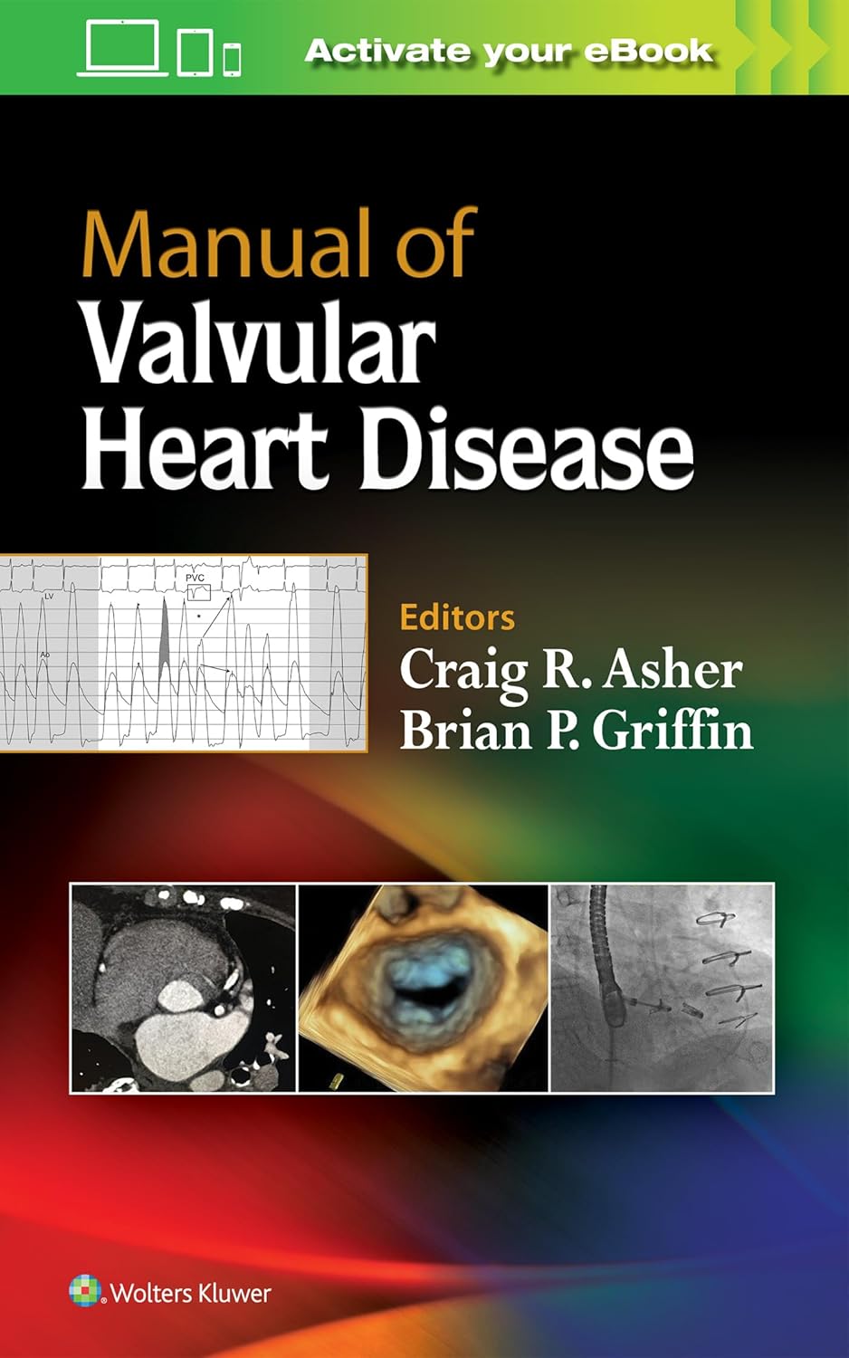 MANUAL OF VALVULAR HEART DISEASE 1ST/2018  -  CRAIG ASHER