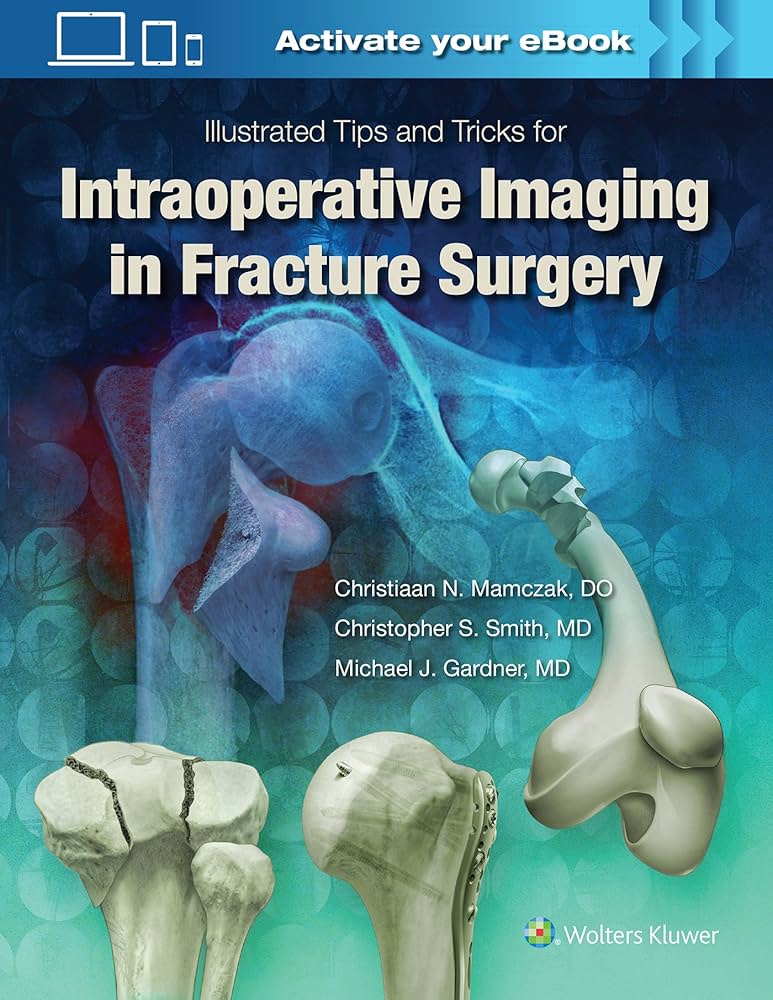 ILLUSTRATED TIPS AND TRICKS FOR INTRAOPERATIVE IMAGING IN FRACTURE SURGERY 1ST/2018 - CHRISTIAN MAMCZAK (NO ONLINE ACCESS)