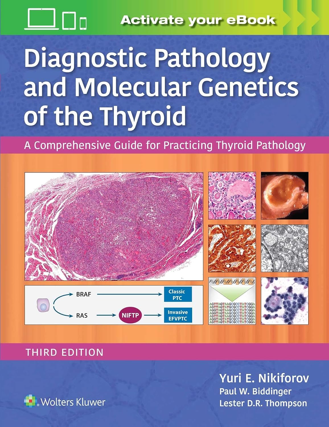 DIAGNOSTIC PATHOLOGY AND MOLECULAR GENETICS OF THE THYROID 1ST/2020 - YURI NIKIFOROV