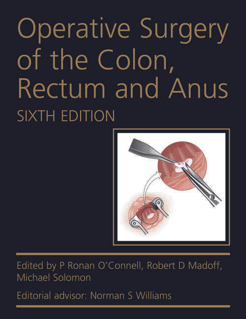 OPERATIV SURGERY OF THE COLON RECTUM AND ANUS 2 VOL SETS 6E/2015