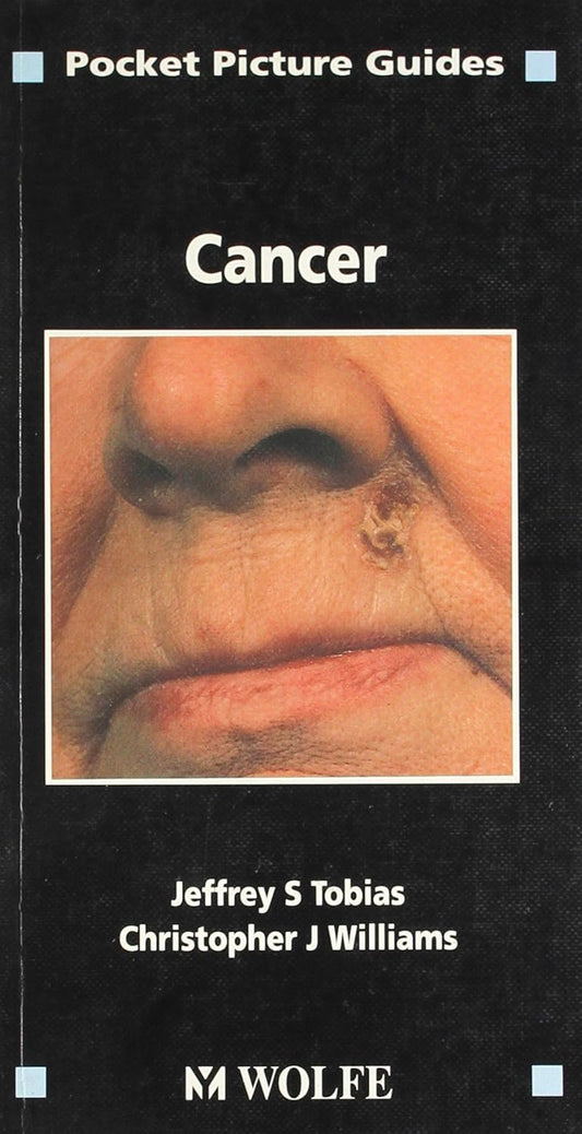 POCKET PICTURE GUIDES CANCER 1ST/1993  -  JEFFERY TOBIAS