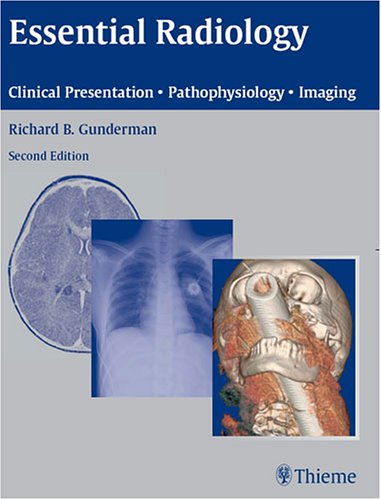 Essential Radiology: Clinical Presentation, Pathophysiology, Imaging 1ST/2006