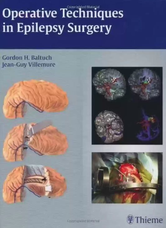 Operative Techniques in Epilepsy Surgery 1ST/2009